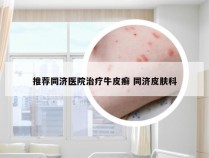 推荐同济医院治疗牛皮癣 同济皮肤科
