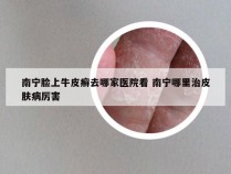 南宁脸上牛皮癣去哪家医院看 南宁哪里治皮肤病厉害