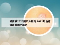 银屑病2023国产外用药 2021年治疗银屑病国产新药