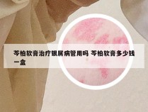 芩柏软膏治疗银屑病管用吗 芩柏软膏多少钱一盒