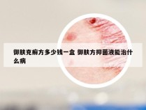 御肤克癣方多少钱一盒 御肤方抑菌液能治什么病
