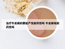 治疗牛皮癣的要能产生耐药性吗 牛皮癣有耐药性吗