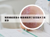 银屑病皮屑变小 银屑病变薄了但又变大了皮屑多