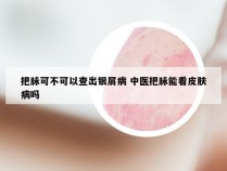 把脉可不可以查出银屑病 中医把脉能看皮肤病吗