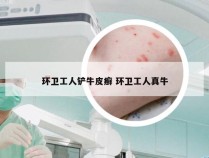环卫工人铲牛皮癣 环卫工人真牛