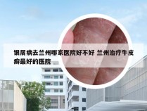 银屑病去兰州哪家医院好不好 兰州治疗牛皮癣最好的医院