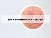 菌菇对牛皮癣有影响吗 牛皮菌能吃吗