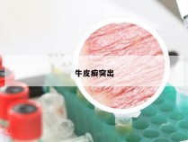 牛皮癣突出