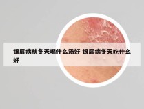 银屑病秋冬天喝什么汤好 银屑病冬天吃什么好