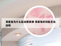 易善复为什么能治银屑病 易善复的功能主治说明