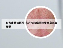 东方皮肤病医院 东方皮肤病医院秦皇岛怎么样啊