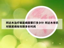 阿达木治疗银屑病需要打多少针 阿达木单抗对银屑病有效期多长时间