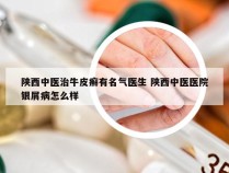 陕西中医治牛皮癣有名气医生 陕西中医医院银屑病怎么样