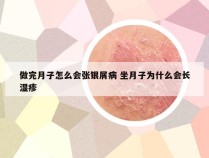做完月子怎么会张银屑病 坐月子为什么会长湿疹