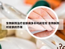 生物制剂治疗皮肤病多长时间见效 生物制剂对皮肤的作用
