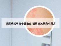 银屑病关节炎中医治愈 银屑病关节炎中药方
