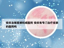 安庆治银屑病权威医院 安庆有专门治疗皮肤的医院吗