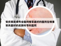安庆银屑病专业医院哪家最好的医院在哪里 安庆最好的皮肤科专科医院