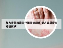 复方青黛胶囊治疗银屑病观察 复方青黛膏治疗银屑病