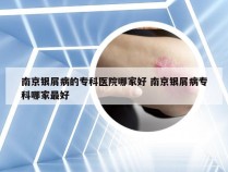 南京银屑病的专科医院哪家好 南京银屑病专科哪家最好