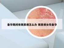 备孕期间有银屑病怎么办 银屑病女性备孕