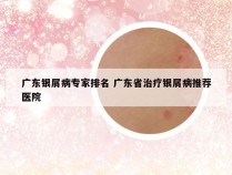 广东银屑病专家排名 广东省治疗银屑病推荐医院