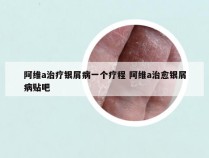 阿维a治疗银屑病一个疗程 阿维a治愈银屑病贴吧
