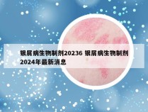 银屑病生物制剂20236 银屑病生物制剂2024年最新消息