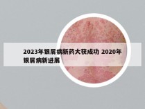 2023年银屑病新药大获成功 2020年银屑病新进展