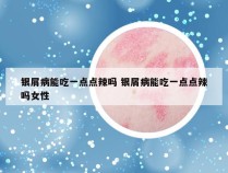 银屑病能吃一点点辣吗 银屑病能吃一点点辣吗女性