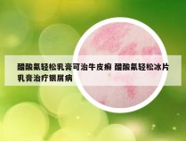 醋酸氟轻松乳膏可治牛皮癣 醋酸氟轻松冰片乳膏治疗银屑病