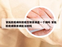 掌跖脓疱病和脓疱型银屑病是一个病吗 掌跖脓疱病银屑病能治好吗