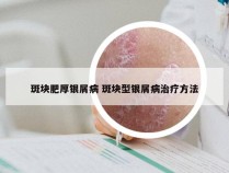 斑块肥厚银屑病 斑块型银屑病治疗方法