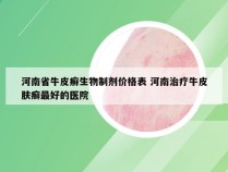 河南省牛皮癣生物制剂价格表 河南治疗牛皮肤癣最好的医院