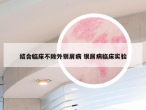 结合临床不除外银屑病 银屑病临床实验