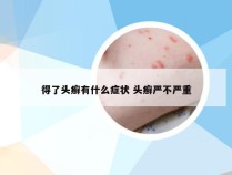 得了头癣有什么症状 头癣严不严重