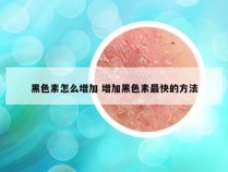 黑色素怎么增加 增加黑色素最快的方法