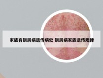 家族有银屑病遗传病史 银屑病家族遗传规律