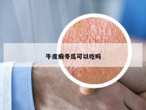 牛皮癣冬瓜可以吃吗