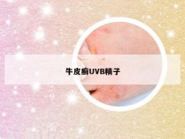 牛皮癣UVB精子
