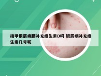 指甲银屑病腰补充维生素D吗 银屑病补充维生素几号呢