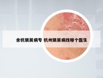 余杭银屑病专 杭州银屑病找哪个医生