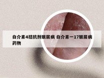 白介素4拮抗剂银屑病 白介素一17银屑病药物