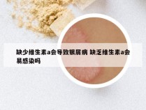 缺少维生素a会导致银屑病 缺乏维生素a会易感染吗