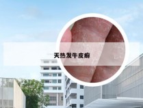 天热发牛皮癣