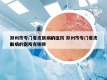 郑州市专门看皮肤病的医院 郑州市专门看皮肤病的医院有哪些