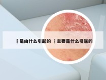 廯是由什么引起的 廯主要是什么引起的