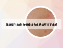 健康证牛皮癣 办健康证有皮肤病可以下来嘛