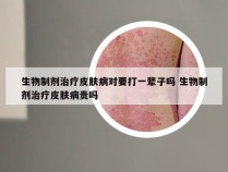 生物制剂治疗皮肤病对要打一辈子吗 生物制剂治疗皮肤病贵吗