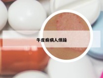 牛皮癣病人烦躁
